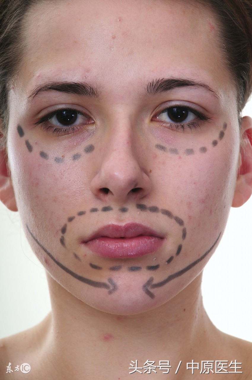 青春痘无需治疗吗,青春痘是过了青春期才能根治吗