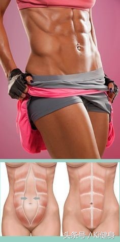 腹直肌及腹直肌分离,产后腹直肌分离