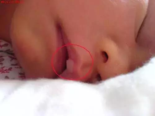 月嫂总结那些事：新生儿这28种情况是正常的