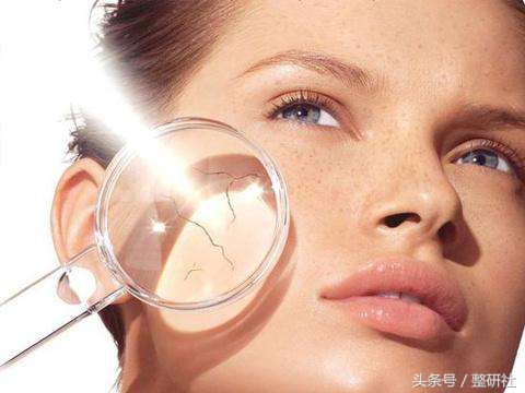 光电祛痘坑效果,光电祛斑拯救麻子脸