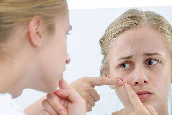 真实长痘历程,三年的长痘经历