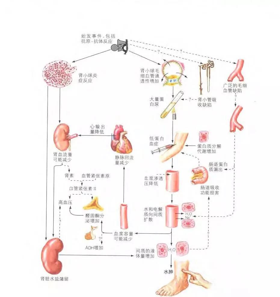 活人被尿憋死含义,活人还能被尿憋死的意思