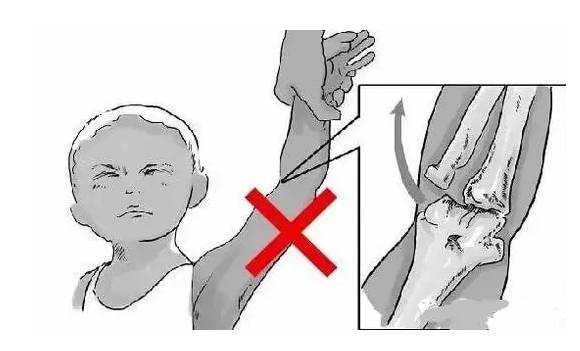 警惕！这2种坐姿，可能导致宝宝驼背、罗圈腿、内八字……