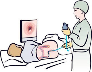 为啥肠道疾病不能用彩超检查,全肠道菌群无创检测