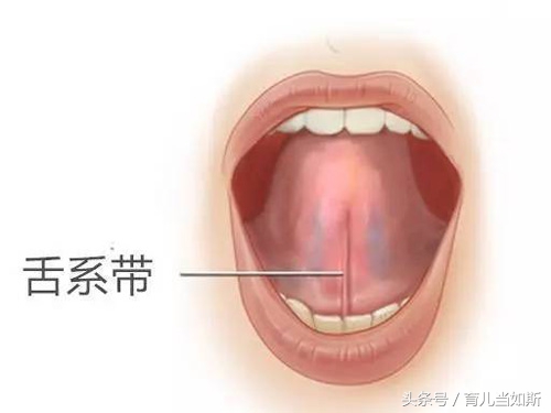 儿童剪舌筋最佳年龄,舌筋短什么时候剪最好