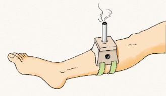 老年人痛风可以艾灸吗,老年人风湿痛可以艾灸吗