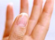 指甲上的月牙渐渐消失是怎么回事,指甲上的月牙是代表健康的状况吗