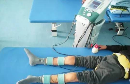 有一种关节肿，叫做滑膜炎