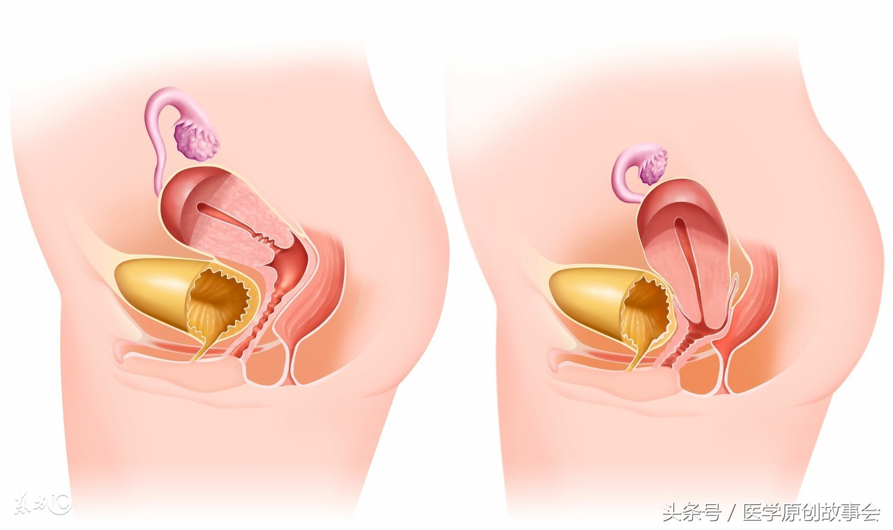 孕妇怀孕怀五胎肚子快不行了,孕妇怀了五胞胎肚子很大疼的要命