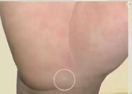 手的颜色能看出健康的问题吗,手健康的表现