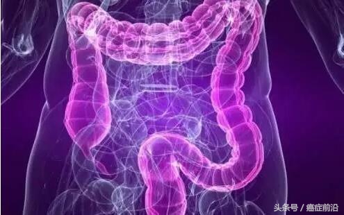 晚期结直肠癌化疗能活多久,87岁直肠癌晚期能口服化疗药物吗