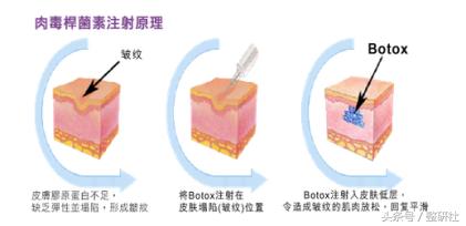 医美联合治疗拒绝“阿婆”面相
