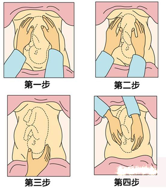 怀孕33胎位不正怎样才能纠正,怀孕胎位不正脐带绕颈一周怎么办