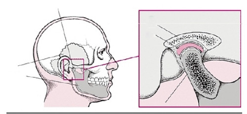 掉下巴怎么缓解,掉下巴了怎么处理