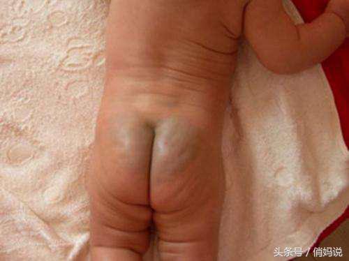 孕妇应该看的小孩,孕妇必看宝宝图册