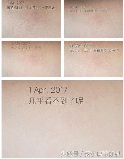 一白遮三丑，可是你知道如何科学美白吗？