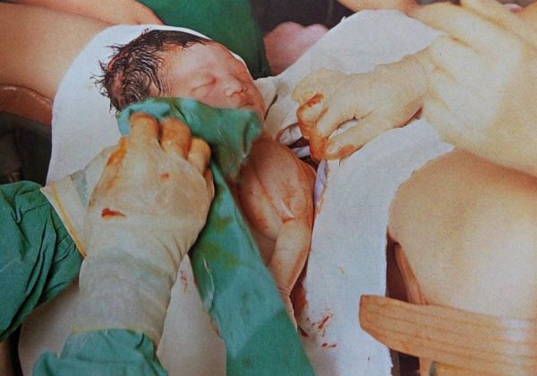 剖腹产修复盆底肌,剖腹产多久可以修复盆底肌