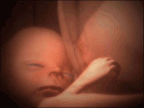 剖腹产修复盆底肌,剖腹产多久可以修复盆底肌