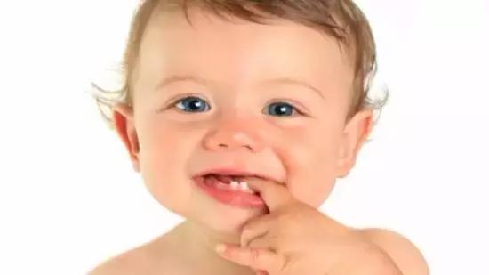 乳牙未掉恒牙长歪了后期会长好吗,宝宝的乳牙歪