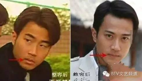 打死不承认整容,打死不承认整容的明星