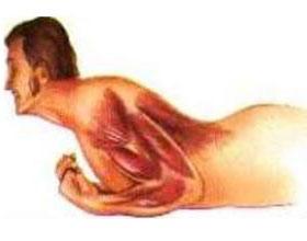 30岁烫伤用打破伤风针么,烫伤起水泡需要打破伤风吗