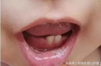 宝宝忽然不爱吃奶粉怎么办,宝宝突然不爱喝奶要怪奶粉吗