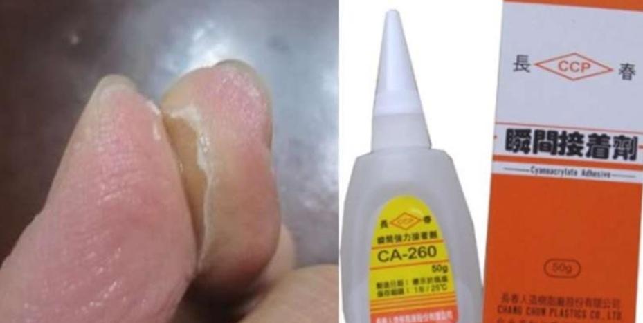 强力胶滴到手上怎样处理,胶水粘住手怎么办小妙招