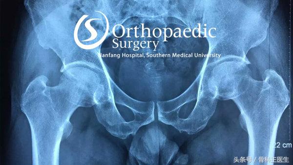 香港产关节疼痛特效药,进口特效药老人关节炎