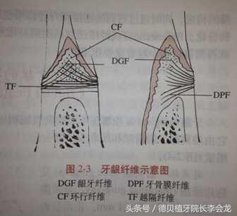 牙齿是怎么固定在牙床上的,牙齿是怎么安装在牙龈上的
