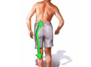 腰背放射性疼痛是什么原因,放射性疼痛的意思