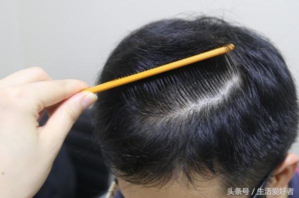 掉头发不多，但就是不长，有什么原因？如何让头发快速生长？