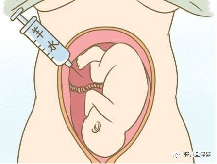 做羊水穿刺的全程过程,地贫羊水穿刺全过程