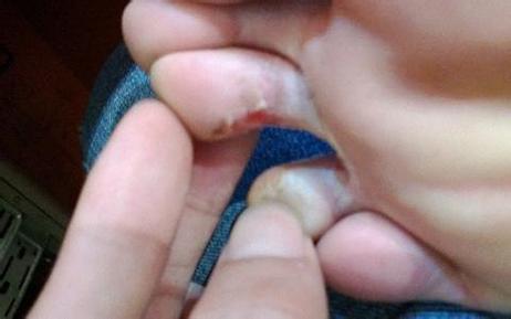 治脚气的小偏方哪一种效果最好,倪海厦治疗脚气除根的小偏方