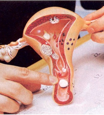 自然分娩会遇到的困难,科普孕妈妈遇急产如何处理