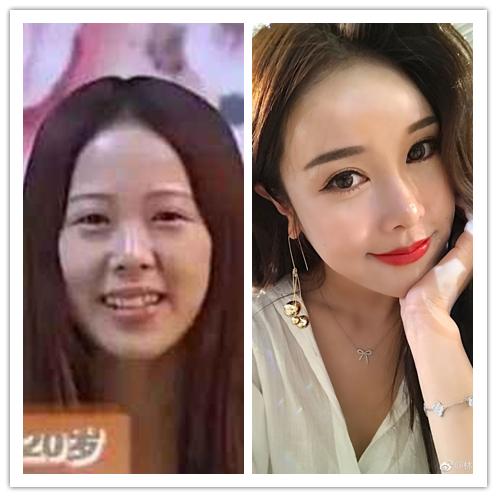 全网整容最成功的网红,全网前十网红整容