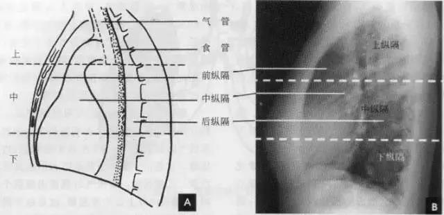 读完该文,让你学会如何看胸片
