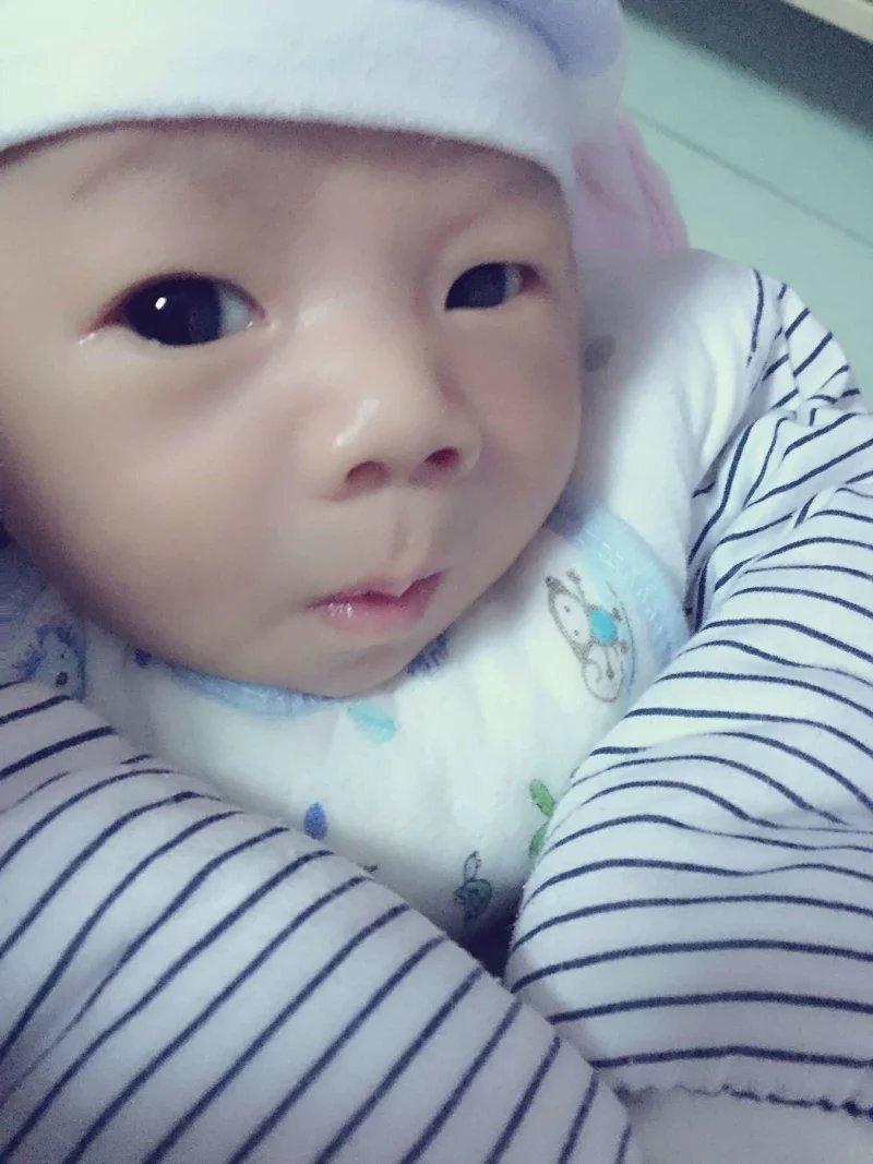 宝妈宝爸o型血宝宝黄疸高怎么办,宝妈宝宝黄疸