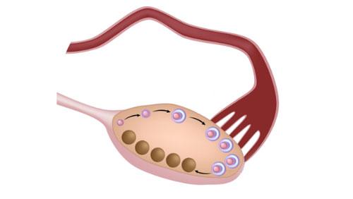卵巢多囊综合症症状怎么治疗,多囊卵巢综合症皮肤有什么症状