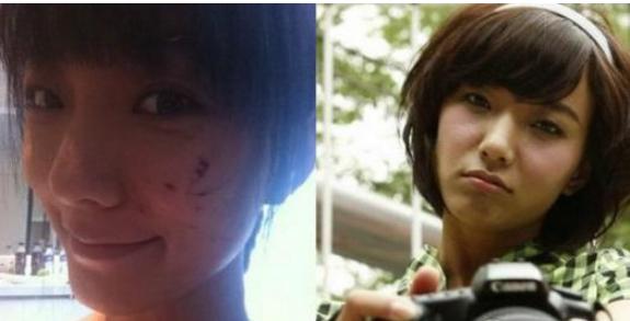 俞灏明烧伤前后对比照任家萱,俞灏明烧伤前后对比照锦绣未央