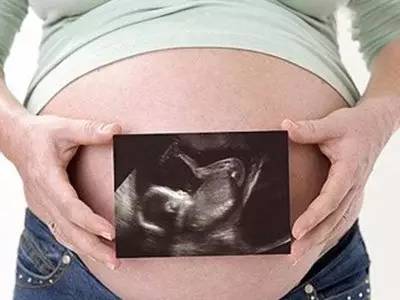 30周胎儿心室强光斑2mm,产检胎儿心脏有斑是怎么回事