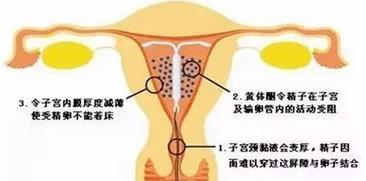 上环对女人有什么危害嘛,人流和上环一起对身体有害吗