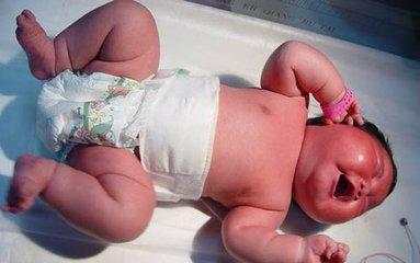 宝宝出生一天眼睛不睁开,宝宝出生几天眼睛闭不严