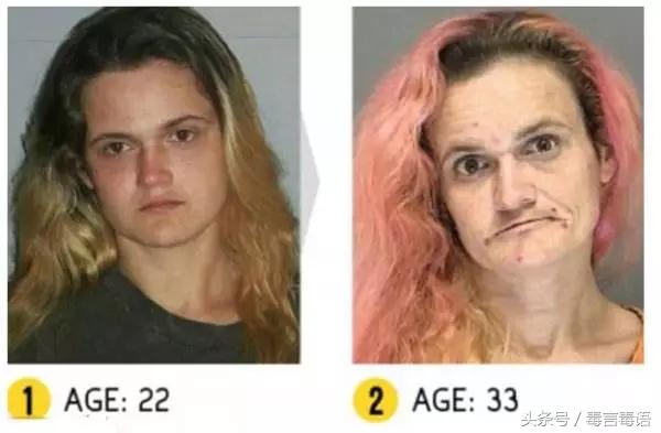 吸毒前后的变化对比,吸毒真的会毁容吗