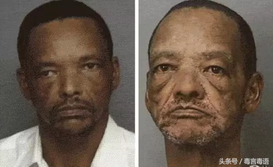 10个吸毒前后的惊人变化,吸毒的人吸毒前后对比图片