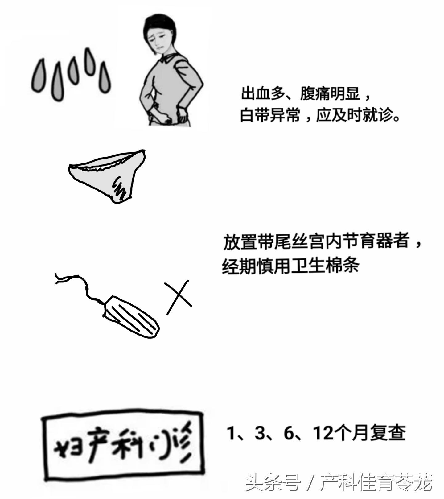 图解宫内节育器放置流程