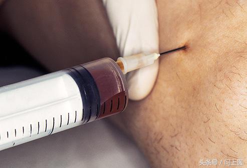 老年人膝盖疼痛的原因和解决方法,上楼梯膝盖疼痛的原因和解决方法