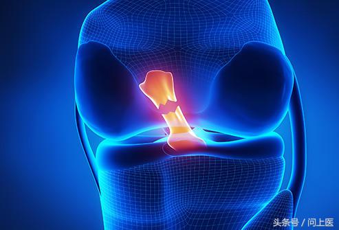 运动后膝盖疼痛的原因和解决方法,跑步后膝盖疼痛的原因和解决方法