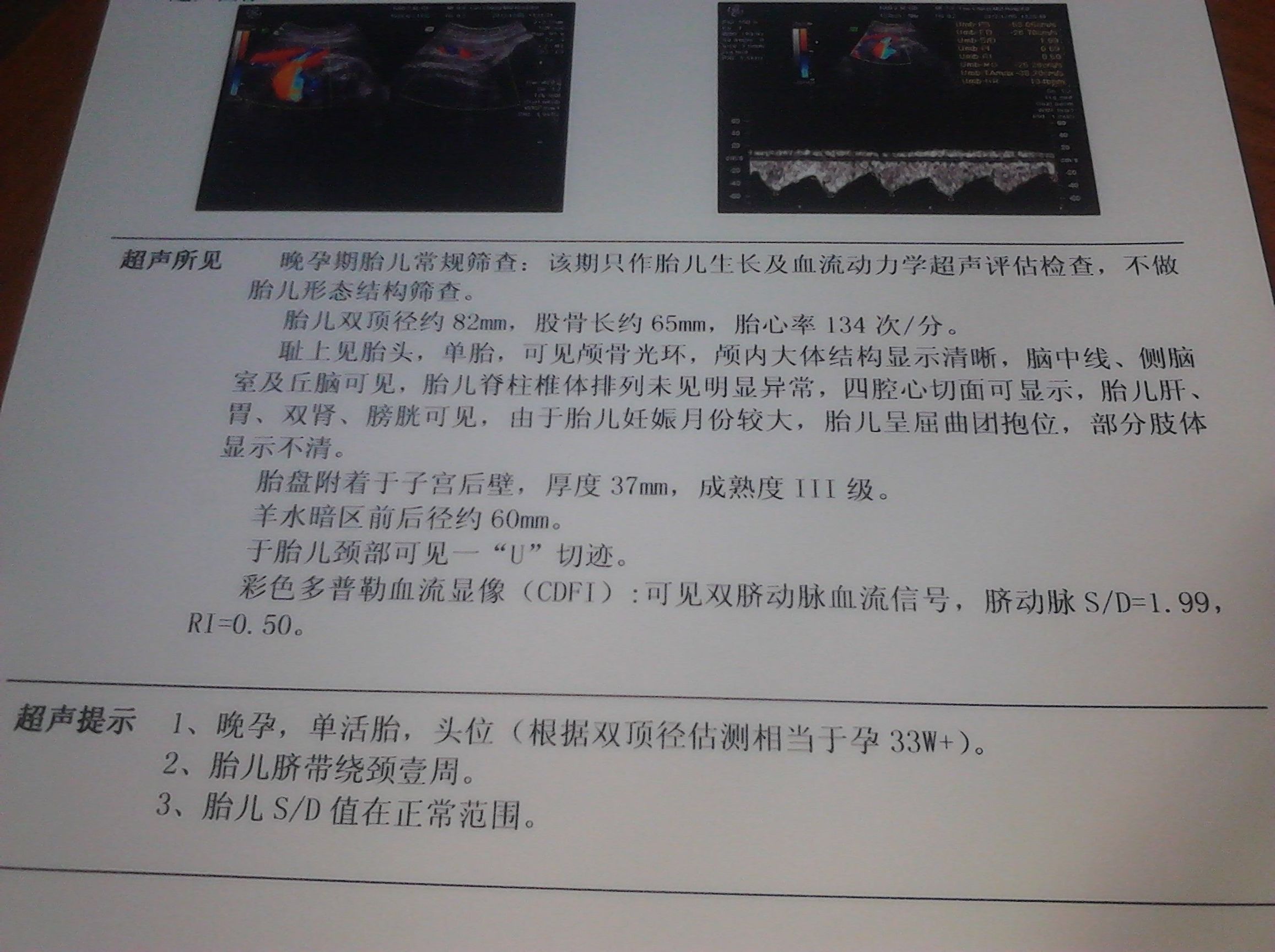 做b超看到的宝宝,谈谈准妈妈如何做b超