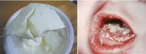 舌尖上的医疗,舌尖上的医疗篇