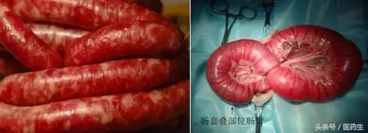 舌尖上的医疗,舌尖上的医疗篇